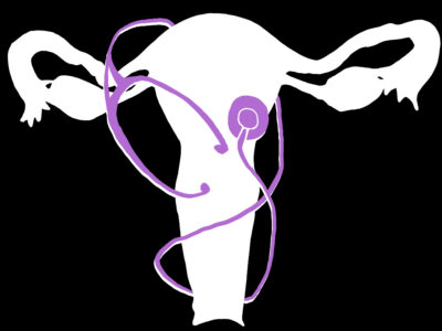 Virginia gynecologic oncologists: “Pro-life” is not pro-life at all