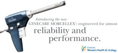 J&J Withdraws Power Morcellators, Citing Risk of Disseminating Cancer