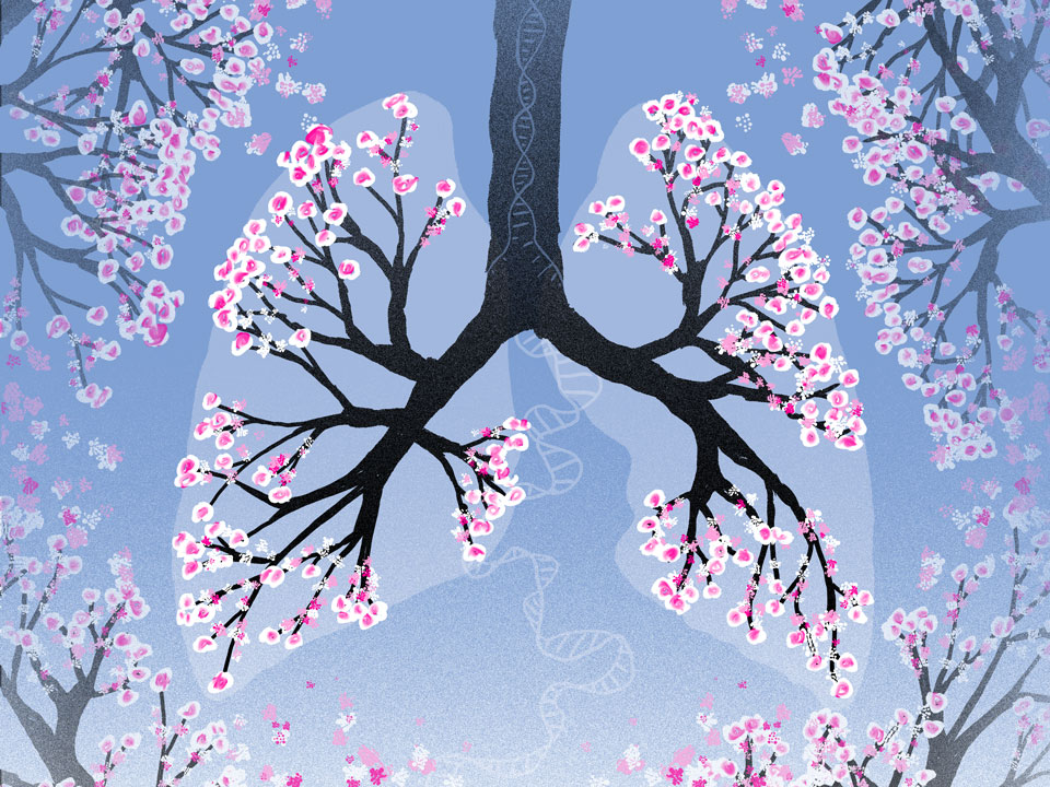Discovery of EGFR mutations dramatically changed lung cancer treatment 20th anniversary of landmark findings