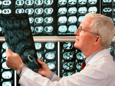 Paul Engstrom, Fox Chase pioneer of cancer prevention, dies at 89