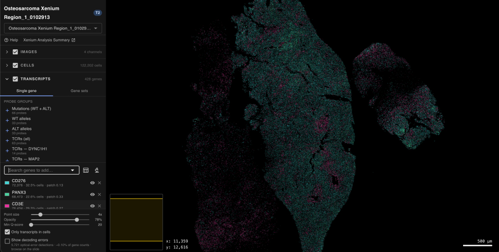 Cross section of organ lit up in turqoise and magenta pixels.