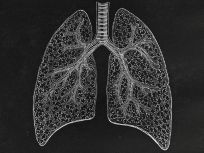 When did stage 3B lung cancer become “early stage”?